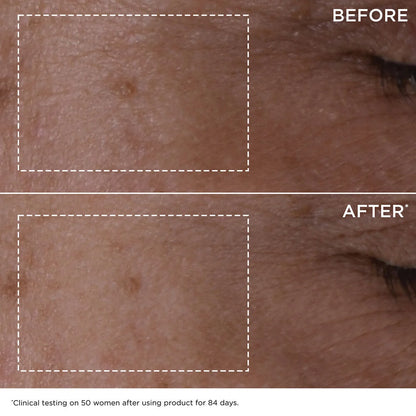 DOUBLE SERUM® - Suero Antiedad + Antiarrugas