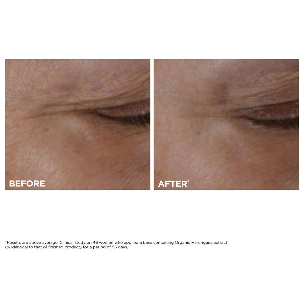 Crema para Ojos Rellenable Total Eye Lift para Reafirmar, Arrugas, Ojeras + Hinchazón