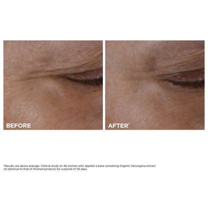 Crema para Ojos Rellenable Total Eye Lift para Reafirmar, Arrugas, Ojeras + Hinchazón