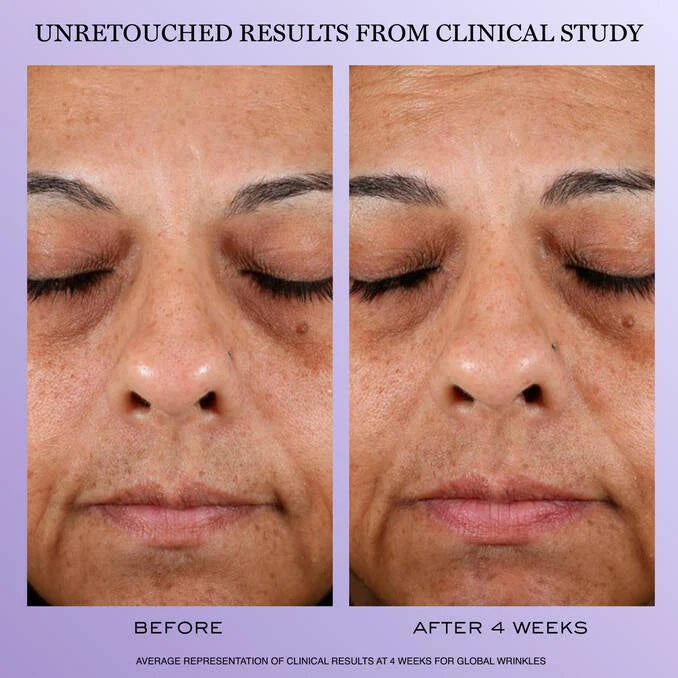 Crème Rénergie H.P.N. 300-Peptides