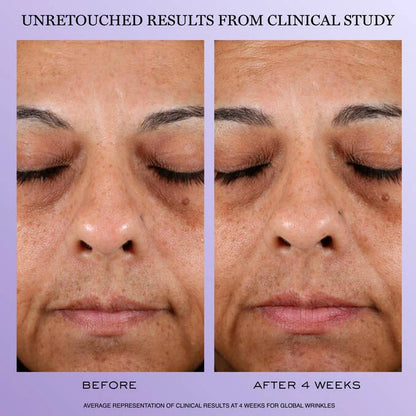 Crème Rénergie H.P.N. 300-Peptides