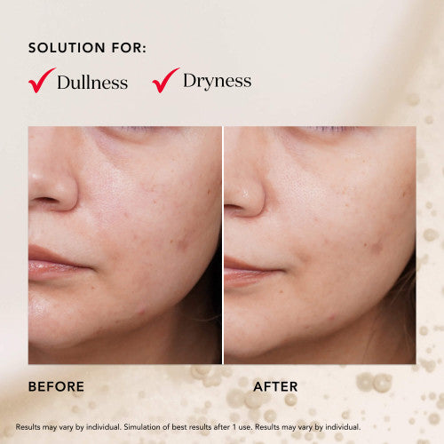 PITERA™ Facial Treatment Mask