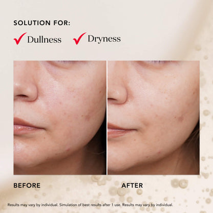 PITERA™ Facial Treatment Mask