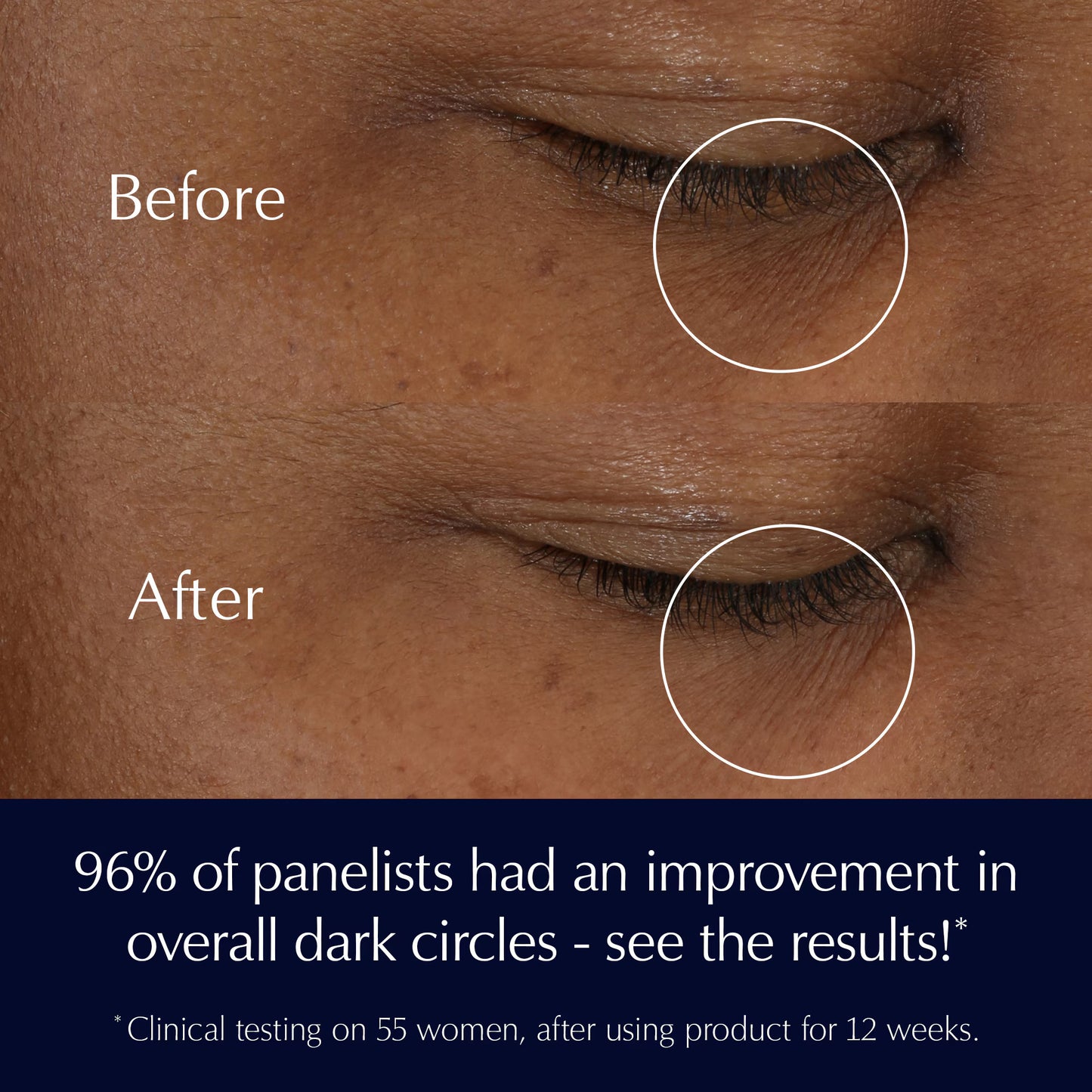 Advanced Night Repair Eye Supercharged Gel-Creme Synchronized Multi-Recovery Eye Cream